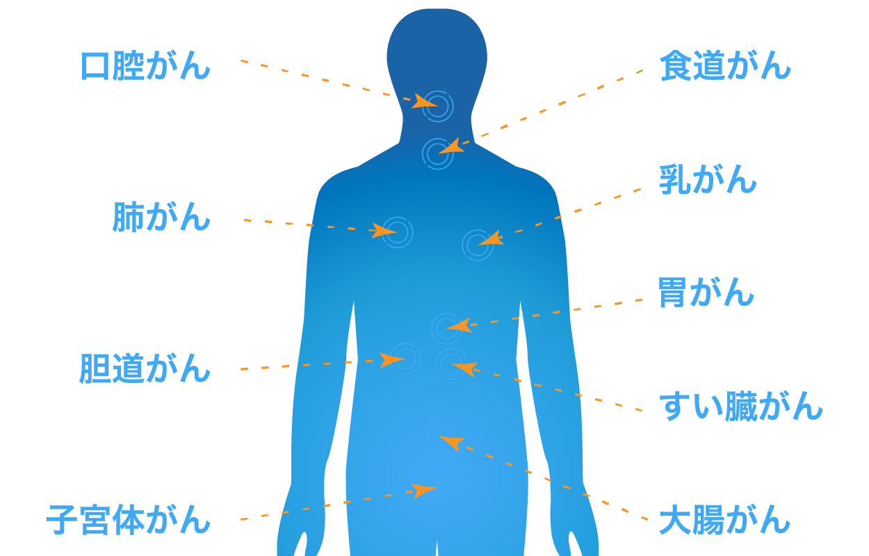 グライコチェッカーは9種のがんをチェック